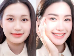 Hình ảnh trước và sau khi thẩm mỹ